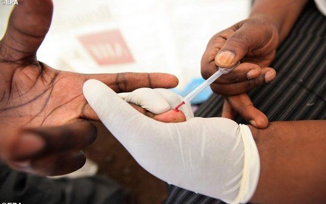 Kwa wanaoogopa kupima, hizi zinaweza kuwa dalili za UKIMWI