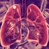 Secondary tuberculosis in lungs.
