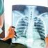 X-ray