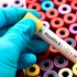 Hepatitis B and C are responsible for 95 percent of Hepatitis-related sicknesses.