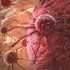 Cancer cell