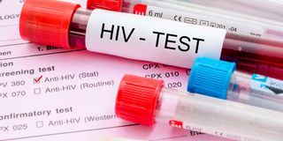 HIV test.
