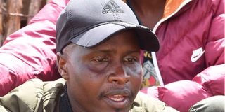 Hillary Kipchumba
