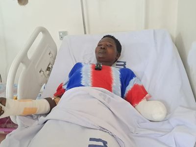 Adaiwa kukatwa kiganja na mtalaka wake